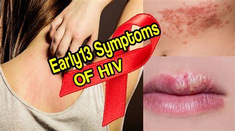 If You See These 13 Symptoms Do An Hiv Test Immediately Natural