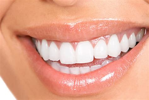 Maintain Your Beautiful Smile With Dental Implants Natural Lotion