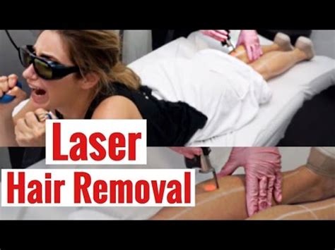 The purpose of removing body hair has changed over time. Laser Hair Removal: My Review 2017 - YouTube