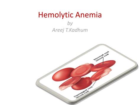 Ppt Hemolytic Anemia By Areej Tkadhum Powerpoint Presentation Free