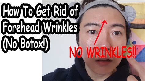 How To Get Rid Of Forehead Wrinkles No Botox Youtube