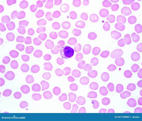 Human Blood Smear Monocyte Stock Photo Image Of Leukocyte