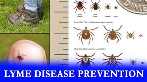 Lyme Disease Preventionhealth Is Wealth ఆరోగ్యం స్పెషల్ Ts24 News