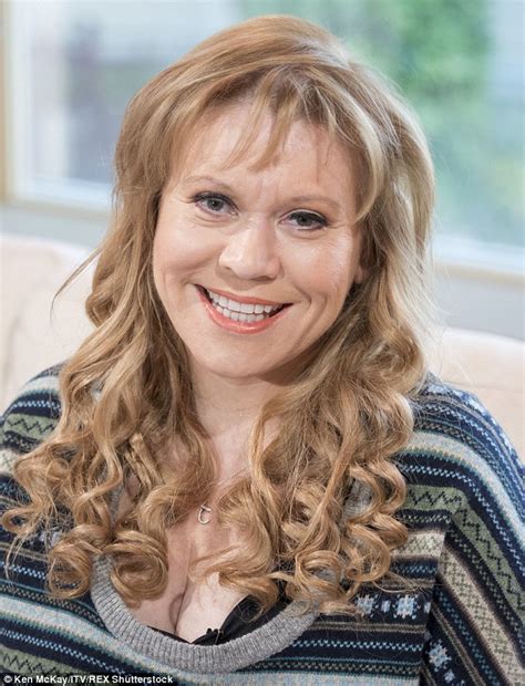 shameless tina malone shows off the gruesome scars after 20 years as