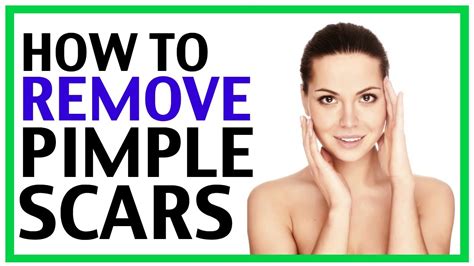 These procedures help to remove scars by gently exfoliating the outermost layer of skin. How To Remove Pimple Scars | How To Remove Pimple Scars ...
