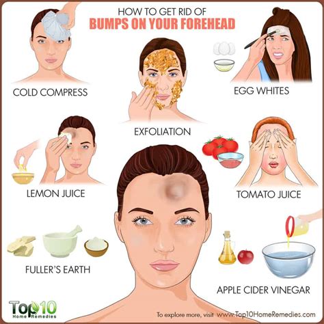 How To Get Rid Of Bumps On Forehead Top 10 Home Remedies