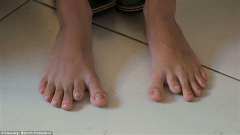 Brazilian Family Have Fingers And Toes Each Daily Mail Online