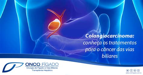 Colangiocarcinoma Conhe A Os Tratamentos Para O C Ncer Das Vias
