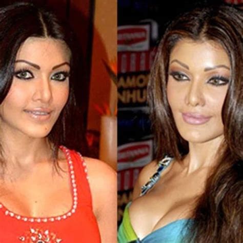 From Shilpa Shetty To Koena Mitra 5 Actresses Who Underwent Nose Jobs