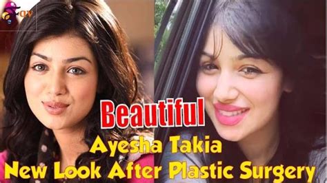 Omg Video Of New Look Of Hot Ayesha Takia After Her Lip Surgery Will