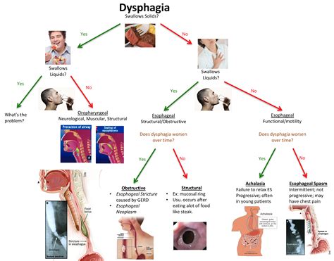 Algorithm For Approach To Patient With Dysphagia Dysp