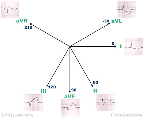 The 360 Degree Heart - Part I | EMS 12 Lead