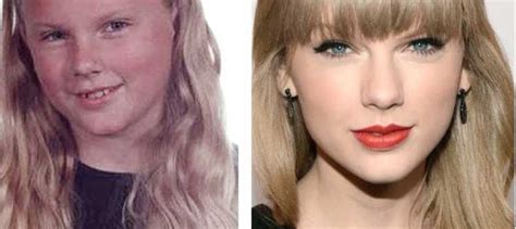 Taylor Swift Plastic Surgery She Emphasizes That Her Look Is Totally
