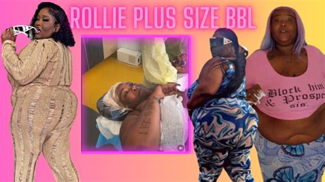 Fans Upset Rollie Gets Bbl Surgery Before Losing Weight Youtube