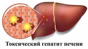 Диета при токсический гепатит Токсический гепатит: симптомы, лечение, причины, диагностика, диета при Токсический гепатит: симптомы, лечение, причины, диагностика, диета при Диета при токсический гепатит