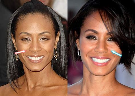 Jada Pinkett Smith Nose Job Before And After Photo Compare In 2021