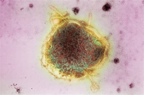 Measles Virus Photograph By Cdcscience Photo Library Fine Art America