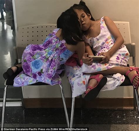 Conjoined Filipino Twins To Separate Despite Death Risk Express Digest