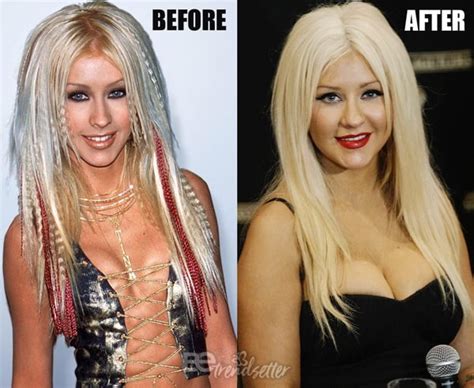 Christina Aguilera Plastic Surgery SECRETS Boob Job Lip Fillers Datakosine