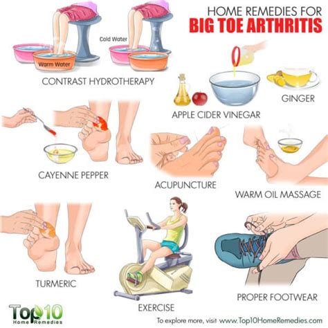 Home Remedies For Big Toe Arthritis Top 10 Home Remedies