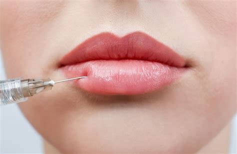 4 Most Popular Lip Fillers That Make Your Pout Last Really Long