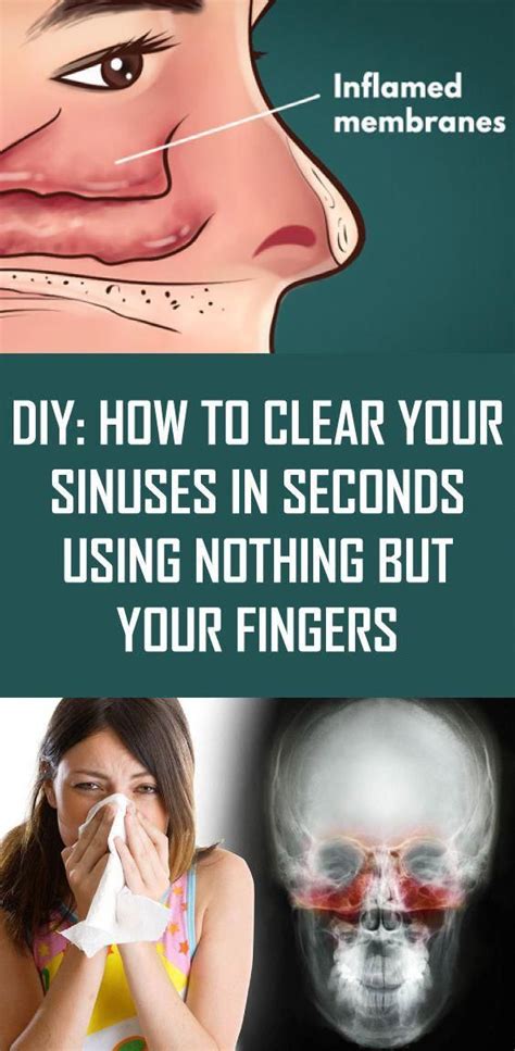 Diy How To Clear Your Sinuses In Seconds Using Nothing But Your