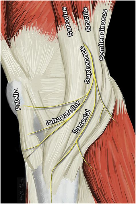 How To Avoid Iatrogenic Saphenous Nerve Injury During Outside In Or