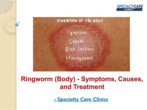 Ringworm Body Symptoms Causes And Treatment By Specialty Care