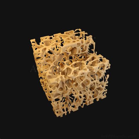 3d Trabeculae Of Spongy Bone Osteoporosis Histology