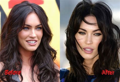 Megan Fox Plastic Surgery Before And After