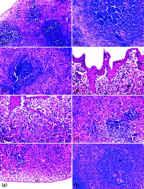 Lm Photomicrographs Of Rat Spleen Tissues Showing Histopathological
