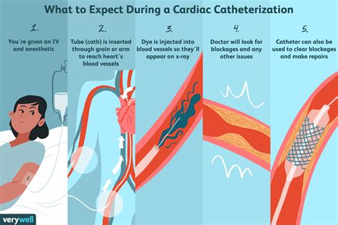 Urinary Catheterization Procedure Ppt Галерија слика