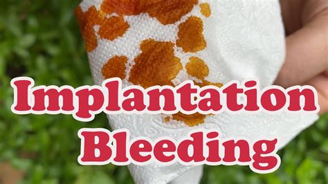implantation bleeding pregnancy ️ here s everything to know about it youtube