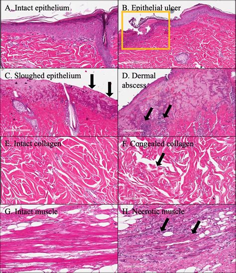 Histology Of Pedicle Skin Flap Tissue A Intact Epithelium B Epithelial