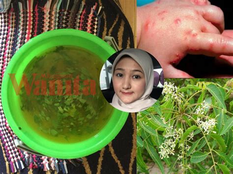 Ulser mulut juga dikenali sebagai serawan, guam, atau mata ikan ini adalah luka pada mukosa mulut. Ubat Ulser Mulut Yang Berkesan - Contoh Kop