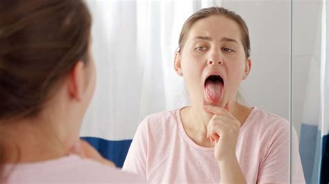 Primele Simptome Ale Cancerului Oral Cancerul Limbii