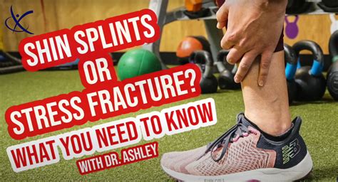 Is It Shin Splints Or A Stress Fracture Feldman Physical Therapy And