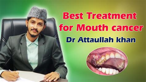Best Treatment For Mouth Cancer Dr Attaullah Khan Youtube
