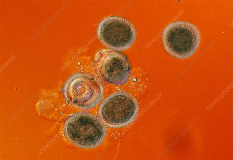 Toxocara Canis Eggs X65 On Orange Background Stock Image Z180
