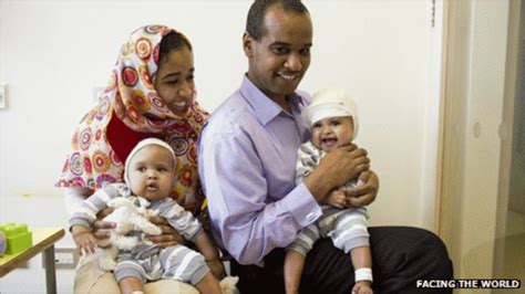 Separating Conjoined Twins Rital And Ritag The Journey Bbc News