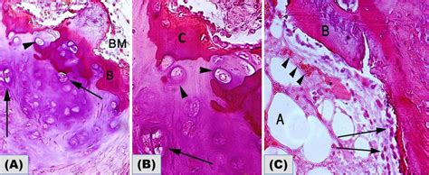 Os Cordis Showing The Spongy Bones 2a Photomicrograph Showing The