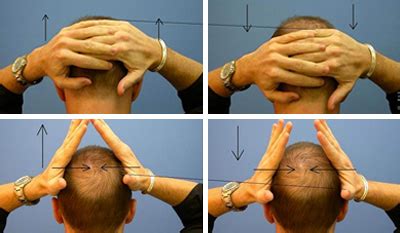 Hair Transplant Scalp Exercises