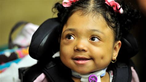 New Drug Gives Growth To Girl Born With No Bones