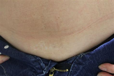We are proud to provide the best, luxury and advanced laser tattoo removal service and training program in the world. Video - Laser Tattoo Removal Services in Los Angeles, CA ...