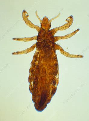 Lm Of Human Head Louse Stock Image Z Science Photo Library