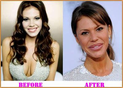 Has Nikki Cox Had Plastic Surgery Before And After Lip Implants And Breast Implants Star