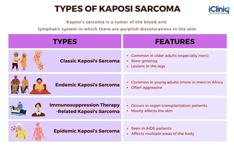 Kaposis Sarcoma Types Signs Symptoms Diagnosis Treatment