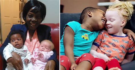 Mother Who Gave Birth To Black And White Twins Says She Thought She
