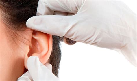 Ruido En El Oído Causas Síntomas Y Tratamiento Cio Salud