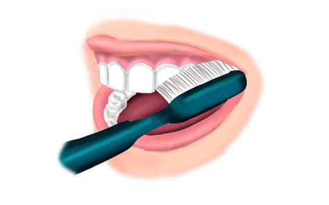 Técnicas De Cepillado Dental Cepillado Dental Ideal Hr